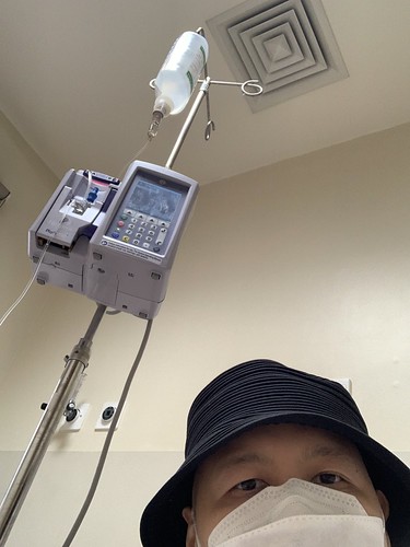 Chemotherapy session 3 of 4