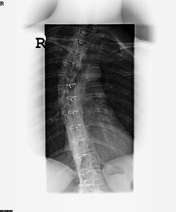 Royalty-free medical x-ray photos free download - Pxfuel